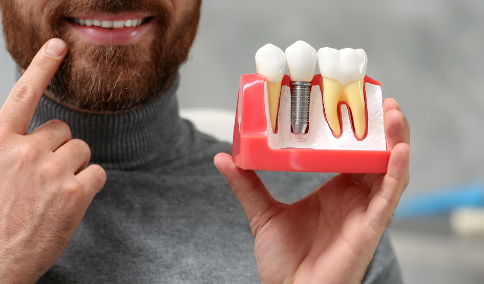 dental implant restorations in Haymarket, VA, dental implant restorations near me in 20169